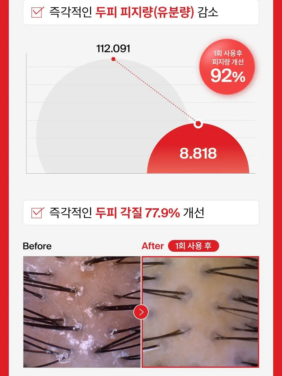 [단독기획] 닥터포헤어 폴리젠 씨크닝 샴푸 400ML기획 (+100ml) 탈모 볼륨 샴푸 상세페이지 31